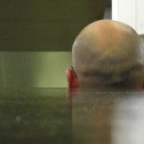 フケが大量に出ると抜け毛につながるって本当?